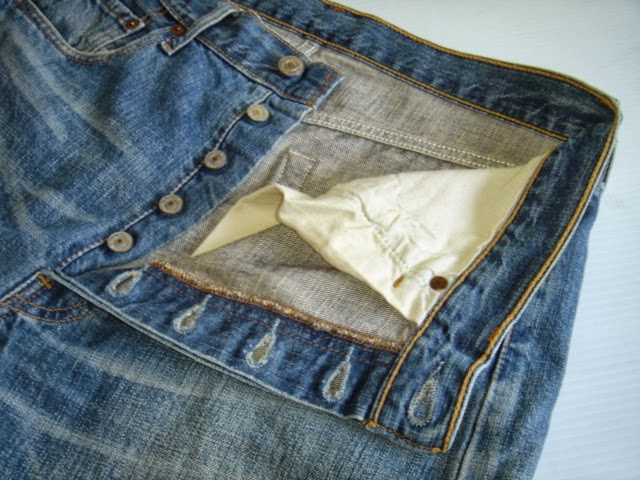 ボタンフライ開放状態