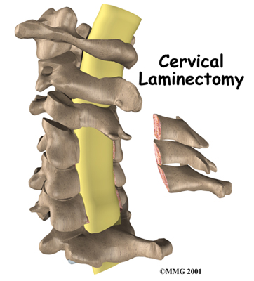 Back Pain & Spine Pain Conditions - Brain.