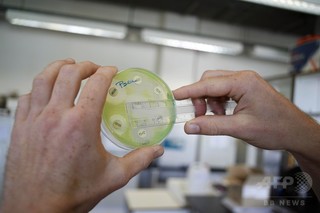 抗生物質を食べる細菌、詳細判明 研究