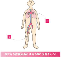 血栓症100