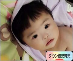 にほんブログ村 子育てブログ ダウン症児育児へ