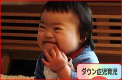 にほんブログ村 子育てブログ ダウン症児育児へ