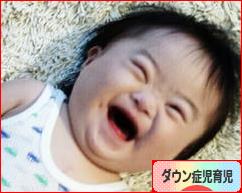 にほんブログ村 子育てブログ ダウン症児育児へ