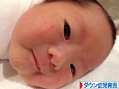 にほんブログ村 子育てブログ ダウン症児育児へ