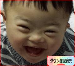にほんブログ村 子育てブログ ダウン症児育児へ