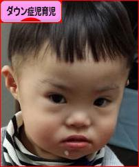 にほんブログ村 子育てブログ ダウン症児育児へ