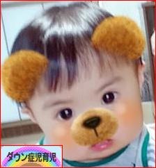 にほんブログ村 子育てブログ ダウン症児育児へ