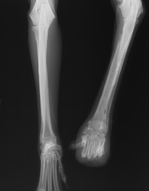 レントゲン画像2