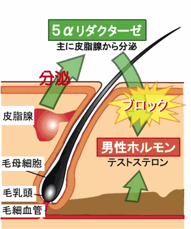薄毛悩み