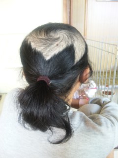 抜毛症について さくらの世界