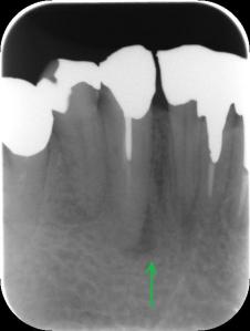 Kr.野中 治療前1