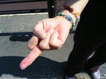 沖縄普天間基地フェンスに貼り付けられた赤いテープを除去作業中、テープに仕込まれたガラス片にてボランティアの女性が怪我。目的の為なら手段は選ばす。手にけがをした人