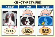 petct.gif