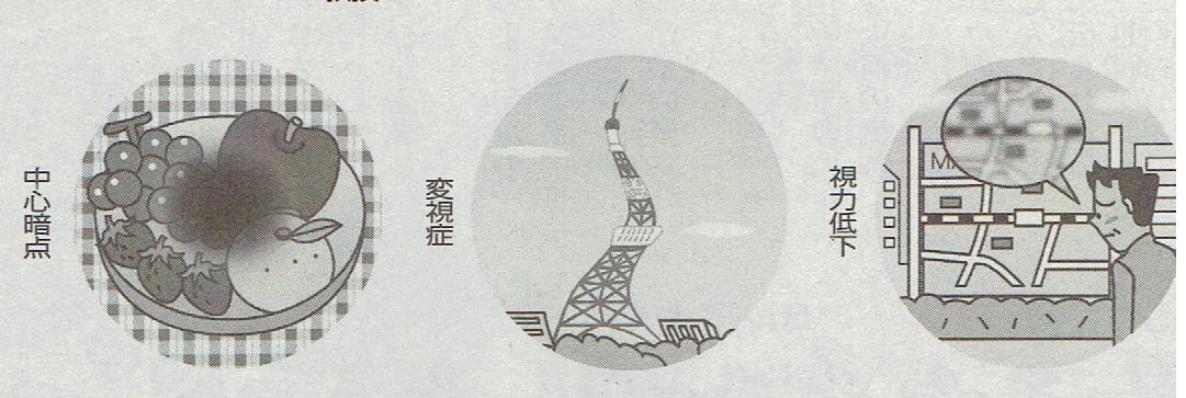 視力低下