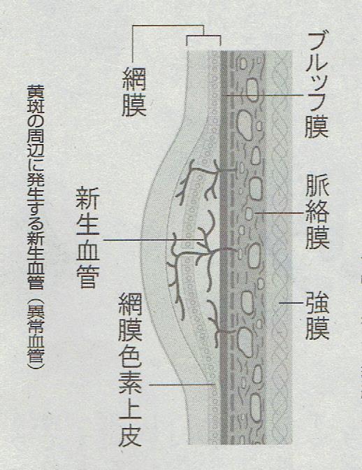 新血管