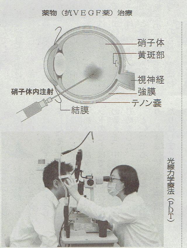 薬物