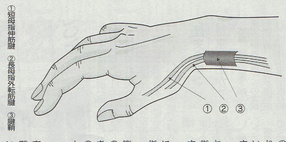 手首