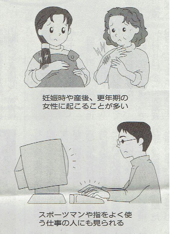腱鞘炎３