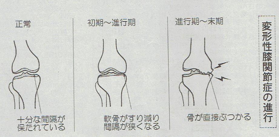 ひざ２