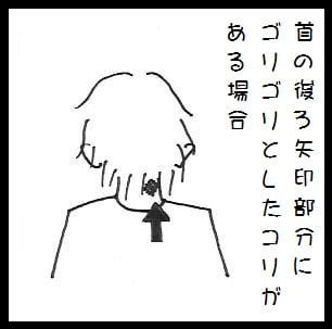 首の後ろってゴリゴリと大きなコリを持ている人が多い はり灸マッサージで免疫力アップ お血改善 疲労などを回復 宮崎市の三快治療院