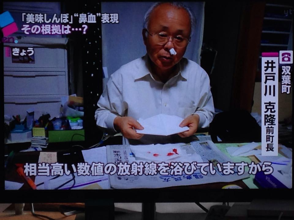 ただちに健康に影響はない と言う嘘から何年も経った今 美味しんぼ 鼻血の真実 ケイの頭ん中 偽りの笑顔で