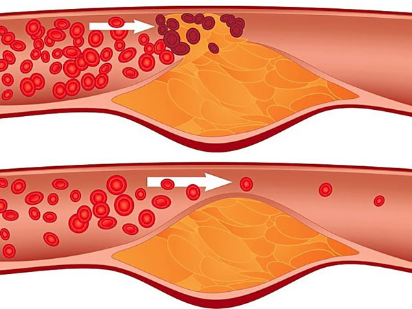 12-tac-dung-cua-hat-chia-va-cach-su-dung-an-toan-4voh