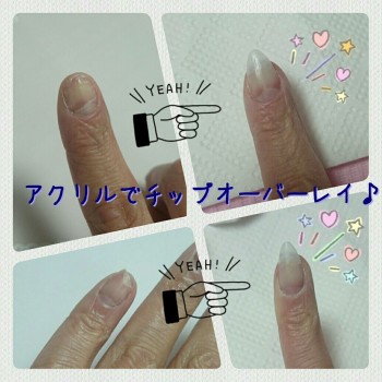 Cenbless　ネイルリペア