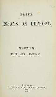 Short Essay on Mother Teresa for School.