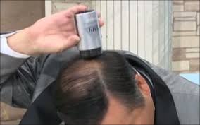 ダウンロード