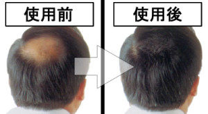 before_after_men