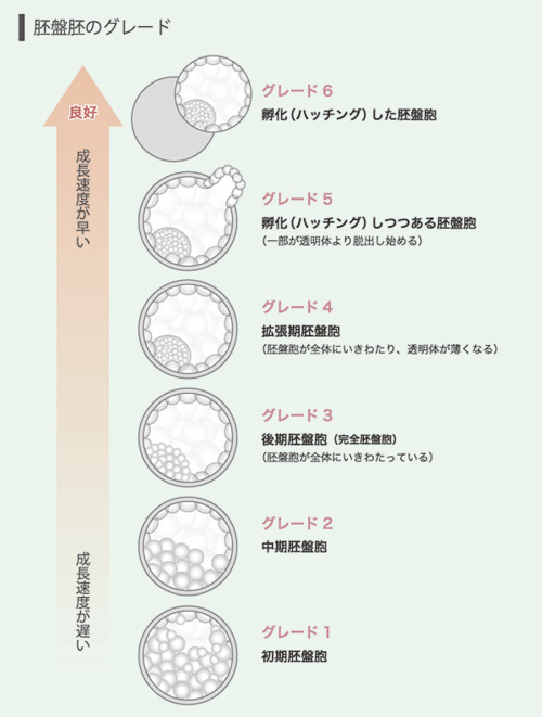 胚盤胞　写真