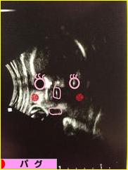 にほんブログ村 犬ブログ パグへ