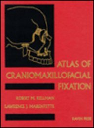 Atlas of Craniomaxillofacial Fixation