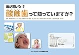 歯が溶ける!? 酸蝕歯って知っていますか?