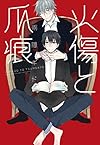 火傷と爪痕 (ディアプラス・コミックス)