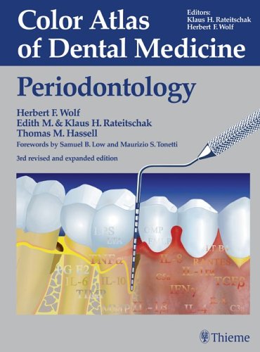 Color atlas of periodontology