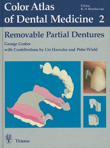 A Colour Atlas of Removable Partial Dentures