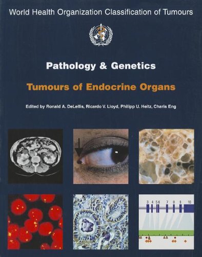 Pathology and Genetics of Tumours of Endocrine Organs