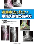 運動療法に役立つ 単純X線像の読み方