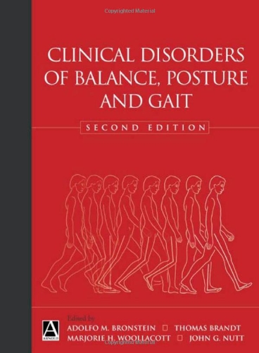 Clinical Disorders of Balance, Posture and Gait