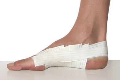 Arch Pain