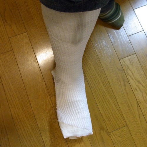 やってしまった