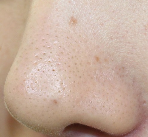 リダーマラボ モイストゲルプラスの悪い口コミは？効果が評判のオールインワンゲルの実力を暴露