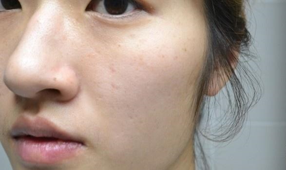 リダーマラボ モイストゲルプラスの悪い口コミは？効果が評判のオールインワンゲルの実力を暴露