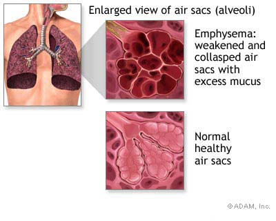 MSJ Diazepam Valium 10mg x 1000.