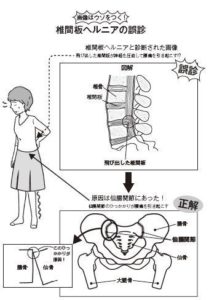 完全保存版 腰痛の９割の治し方 ヨガのススメ 仙腸関節編 元極道でアル中の僧侶 玄龍