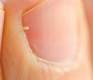 ヒゲを抜いていると 茨城県北茨城市男性専門ヘアサロンショートヘアのフェードからパーマスタイルまでお任せください