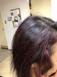 %e3%82%b9%e3%83%88%ef%bc%92