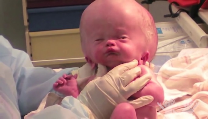 巨大な頭で生まれた赤ちゃん その8年後の姿に感動 リフォームイレブンの公式ブログ