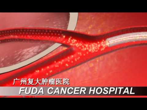 Interventional Radiology for Vascular and.